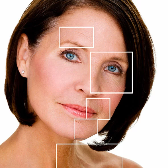 Mikroneedling Proseduru